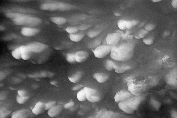 Mammatus (Mammatocumulus) Clouds, Fort Collins, Colorado